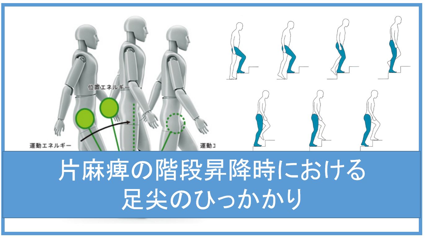 片麻痺の階段昇降時における足尖のひっかかり 脳卒中 脳梗塞のリハビリ論文サマリー 脳卒中 神経系 自費リハビリ施設 Stroke Lab 東京